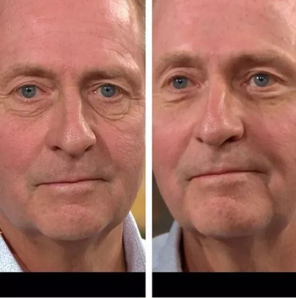 🔥LAST DAY SALE 70% OFF🔥Temporary Firming Eye Cream🔥Limited Time Offer Ending Soon!