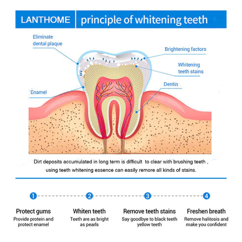 LANTHOME™ Teeth Whitening Essence