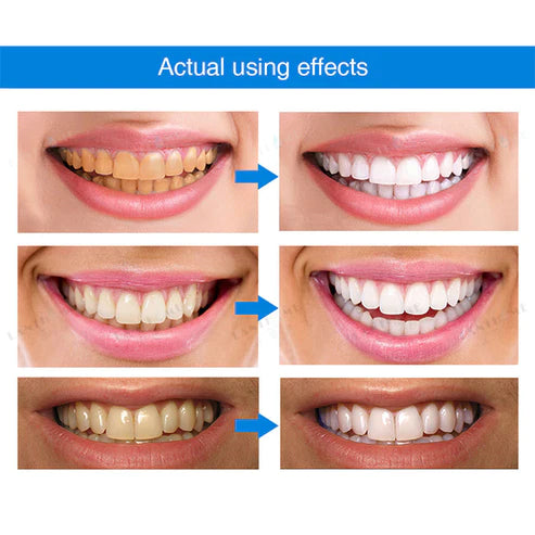LANTHOME™ Teeth Whitening Essence